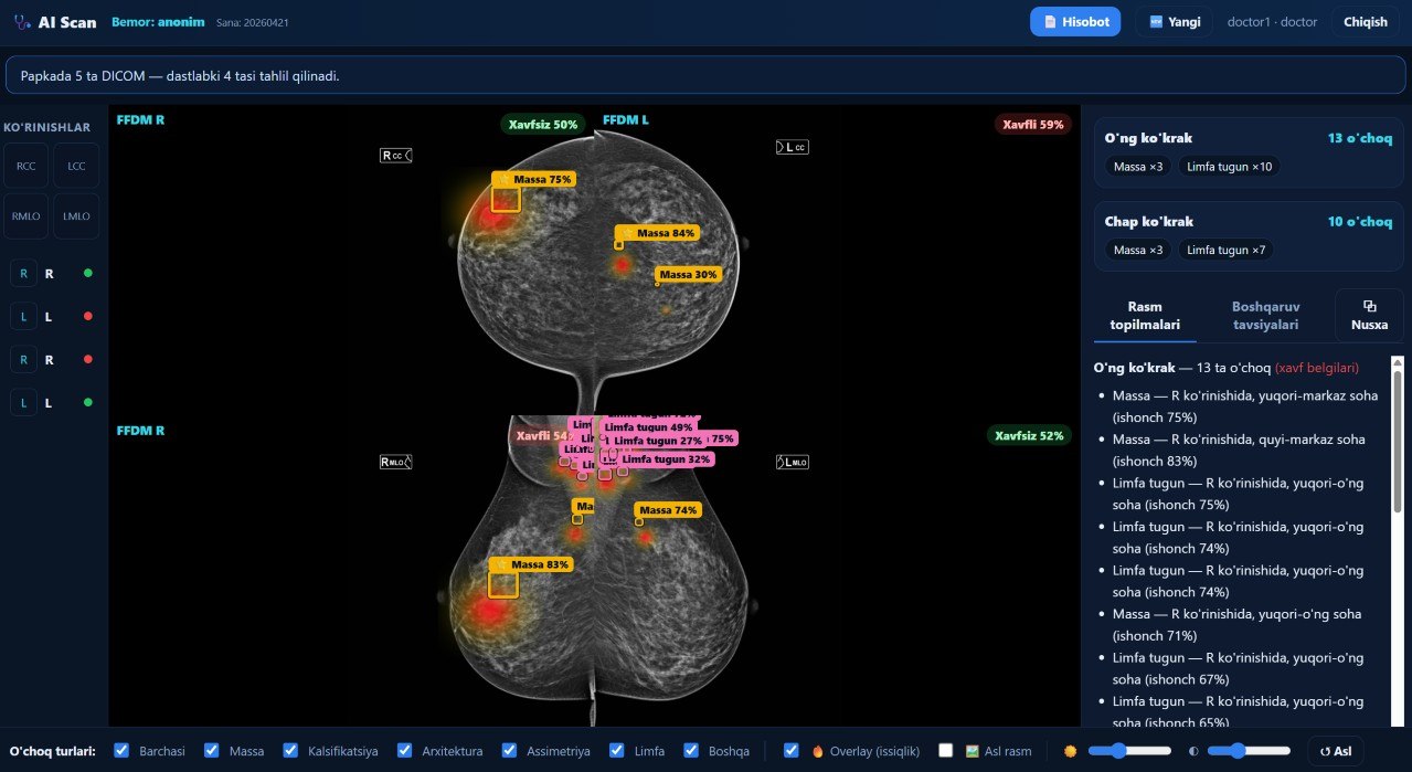 AiScan Mammogram AI Analysis Example